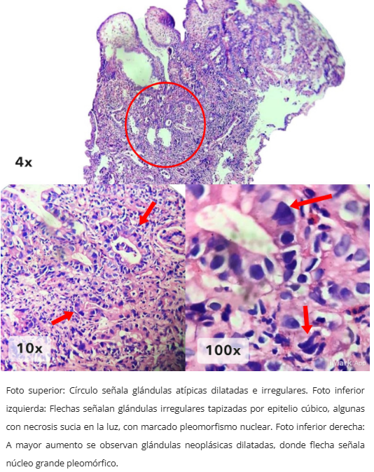 Tipo intestinal