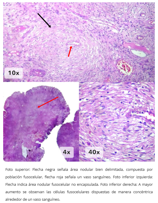 Microscopía de IFP
