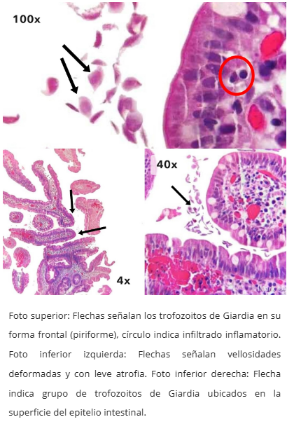 Trofozoitos de Giardia