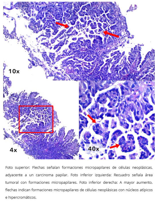 Inmunohistoquímica