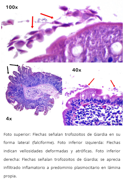 Microscopía Giardiasis