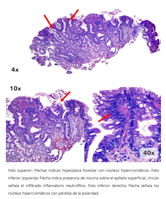 Estudio inmunohistoquímico