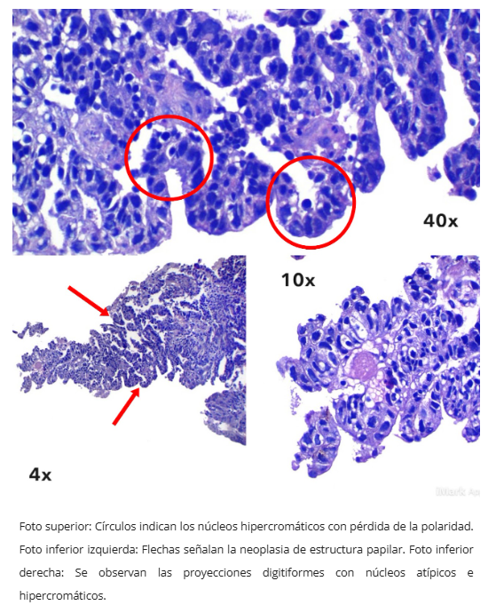 Inmunohistoquímica