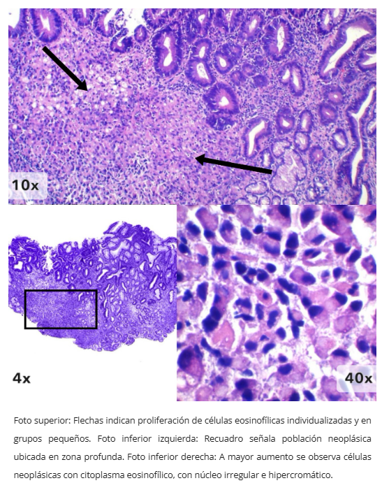Células discohesivas