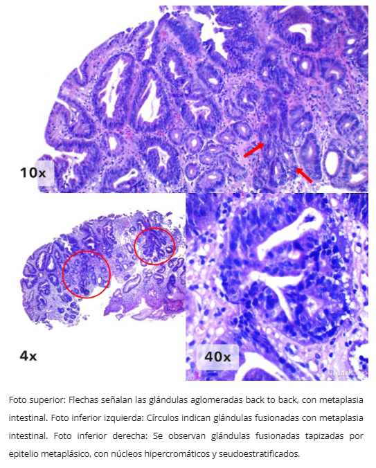 Comparación histológica