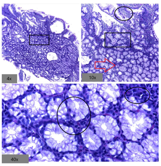 Inmunohistoquímica