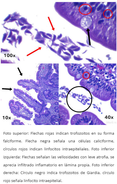 Inmunohistoquímica