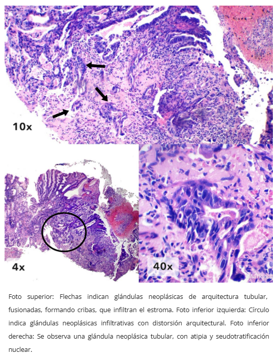 Inmunohistoquímica
