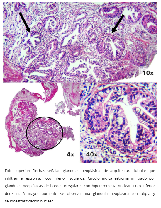Tipificación fenotípica