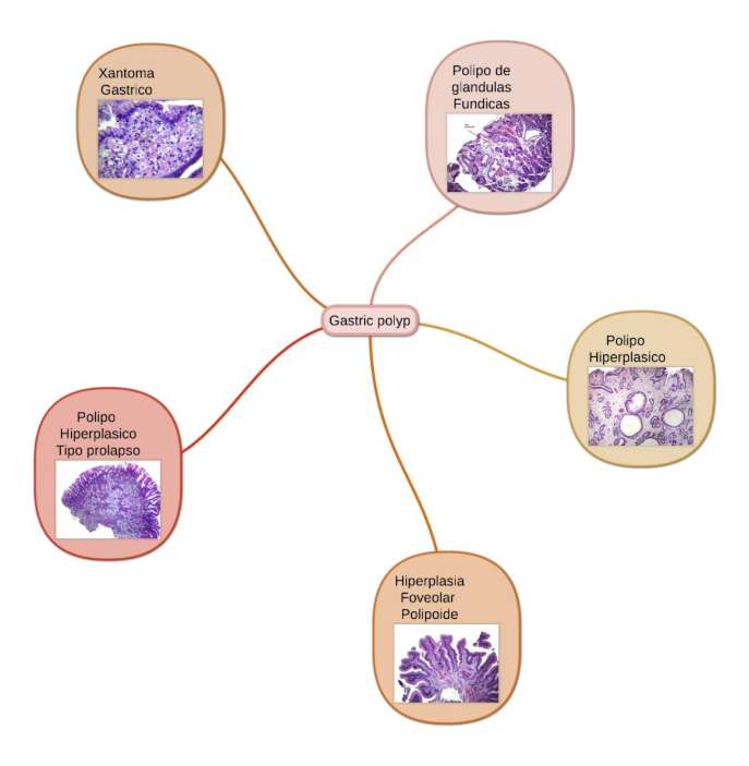 Microscopía de lesiones endoscópicas no neoplásicas