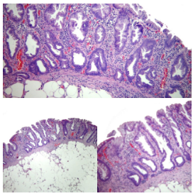 Microscopía SSL