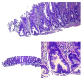 Microscopía SSL