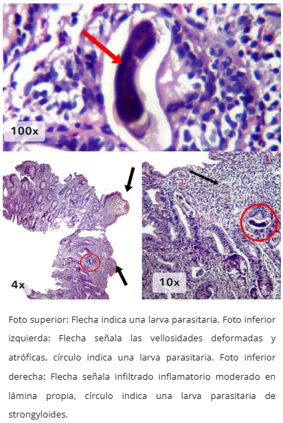 Patrón inflamatorio