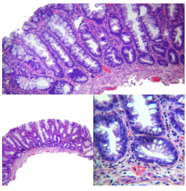 Inmunohistoquímica