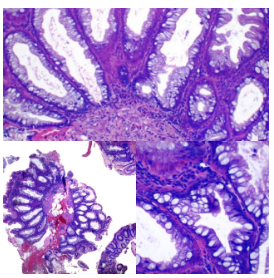Inmunohistoquímica