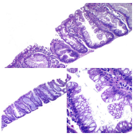 Inmunohistoquímica
