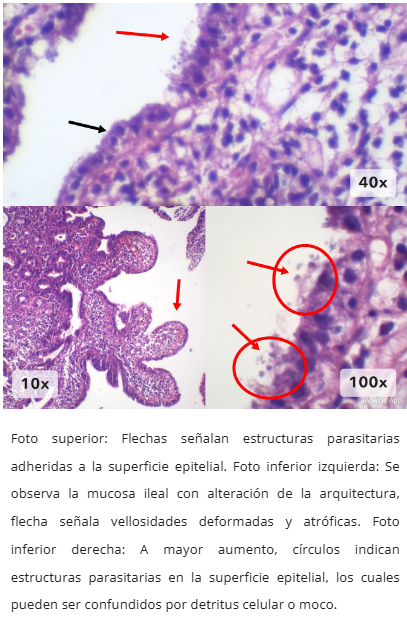 Cryptosporidium en microscopía