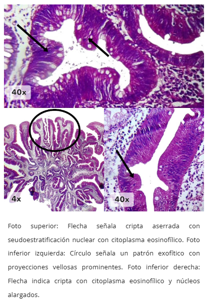 Microscopía TSA