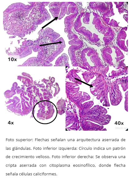 Microscopía TSA