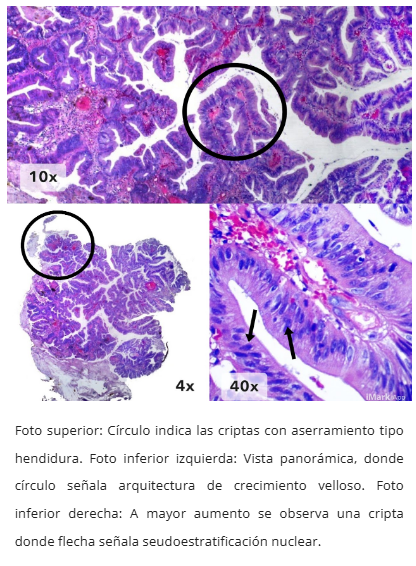 Microscopía TSA