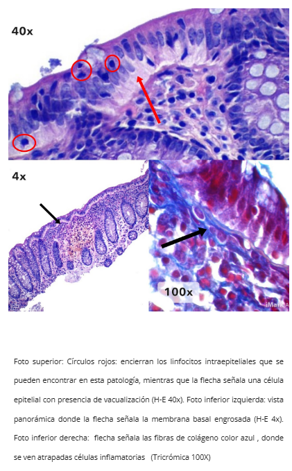 Tricrómica de Masson