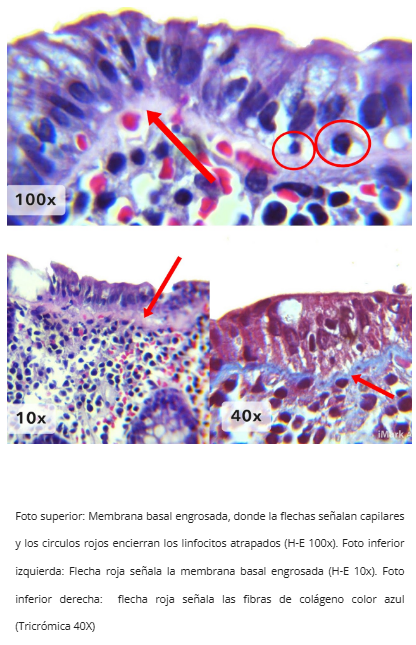Inmunohistoquímica Tenascina