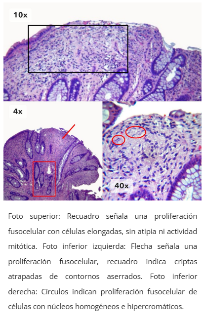 Tabla de diagnóstico diferencial