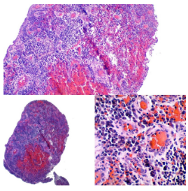 Microscopía baja potencia
