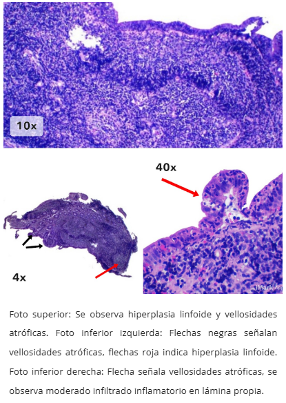 Hallazgos microscópicos
