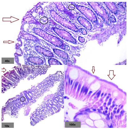 Detalle de espiroquetas