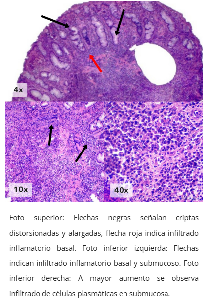 Cambios epiteliales