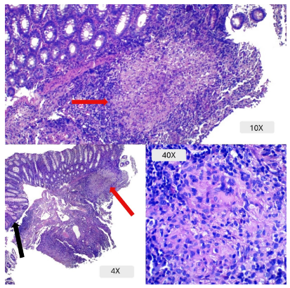 Inmunohistoquímica