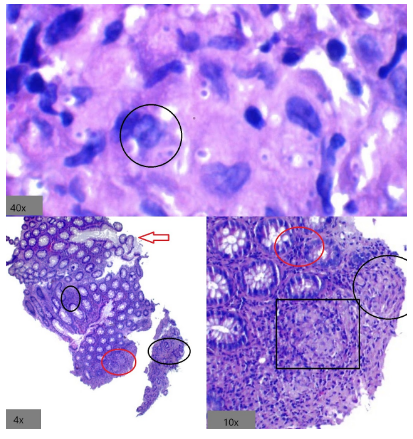 Levaduras de Histoplasma