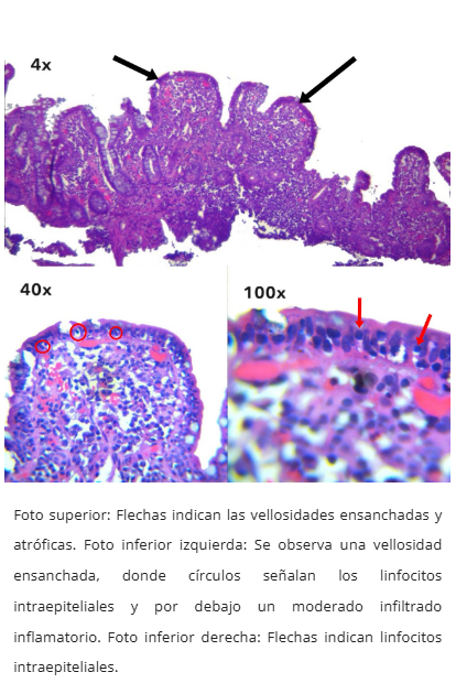 Tinción CD8