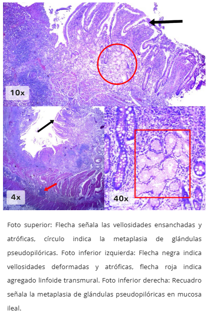 Cambios epiteliales