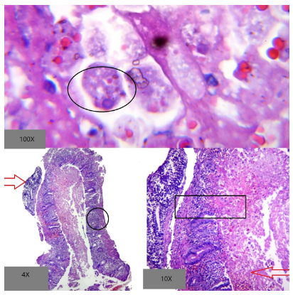 Trofozoítos de Entamoeba histolytica