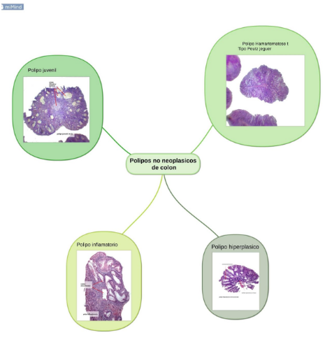 Lesiones endoscópicas de colon